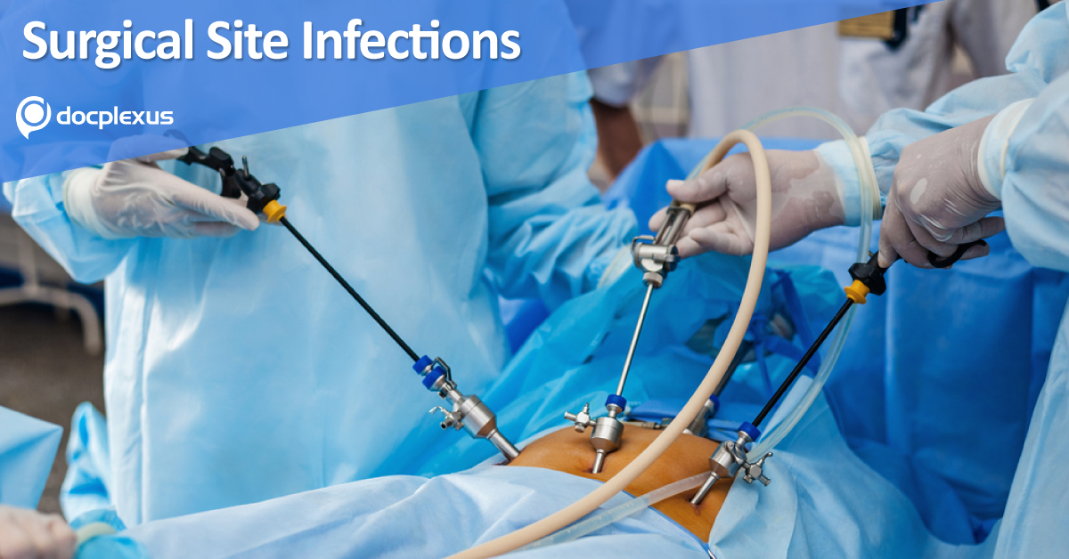 SSIs In Gynecologic Surgery: Prevention Checklist
