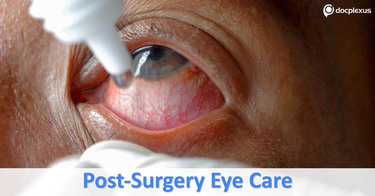 Postoperative Management Of Complications In Cataract Surgery