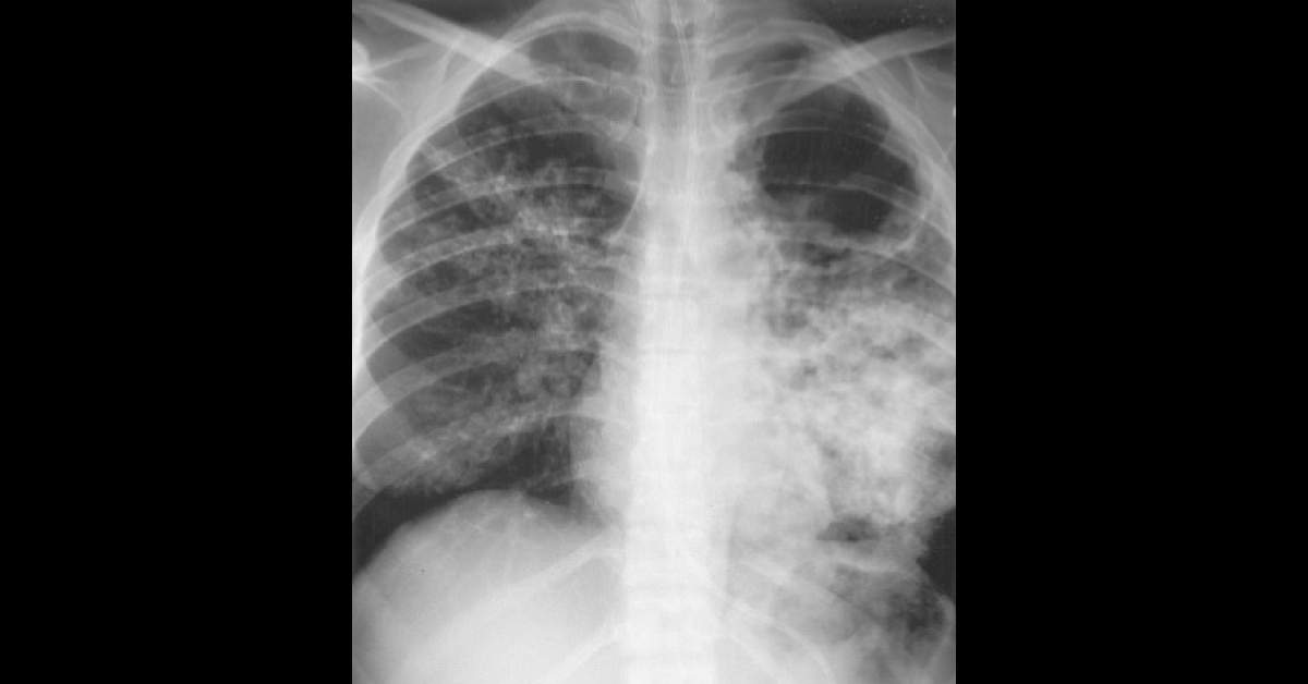 Identify The Underlying Condition