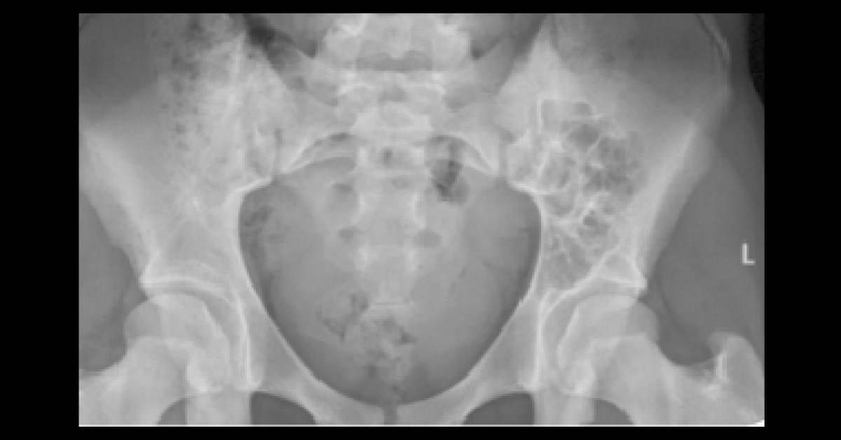 What Does This Radiograph Reveal?