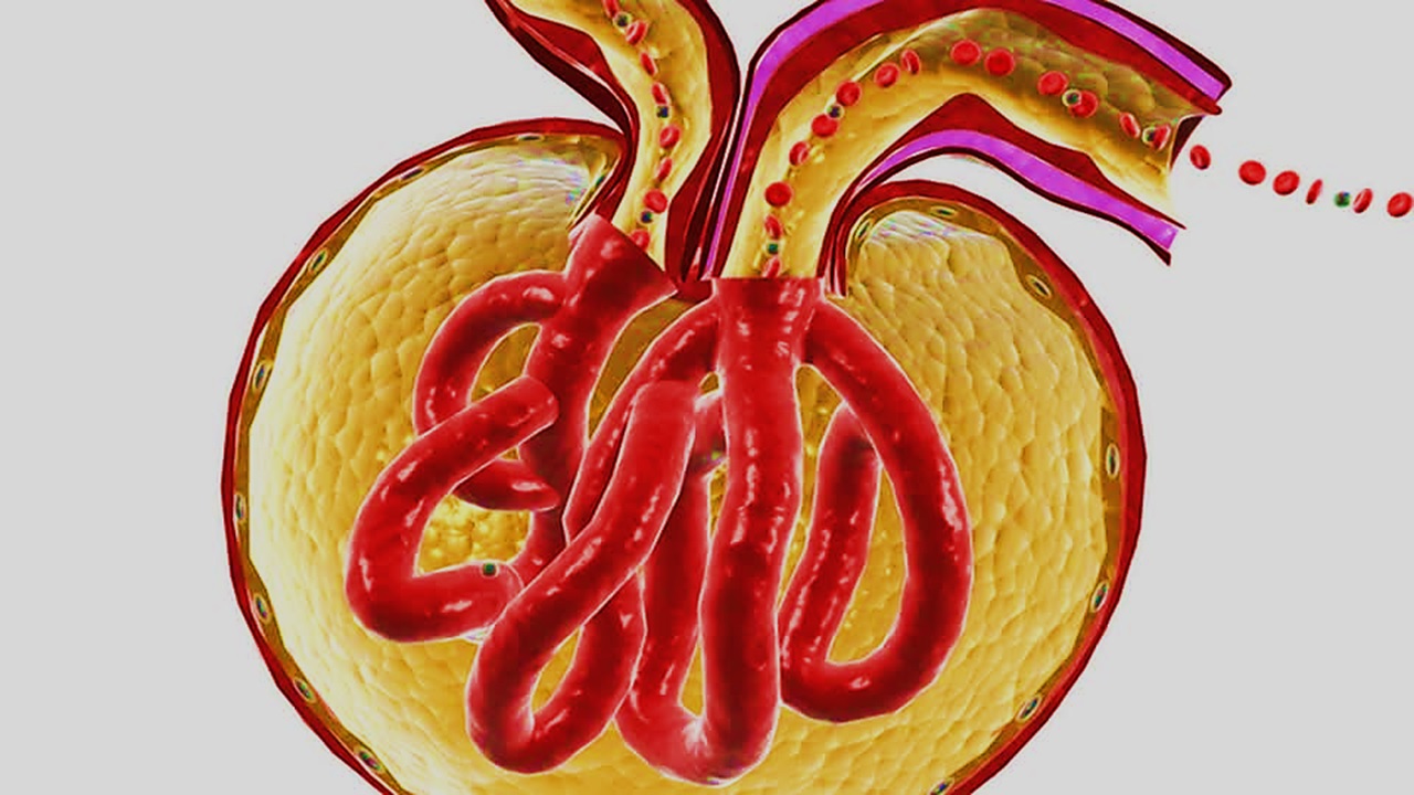 Immunoglobin A Nephropathy (IgAN): Clinical and Experimental Nephrology (2016)