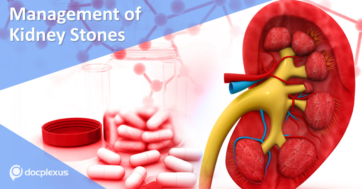 Kidney Stones: European Association of Urology