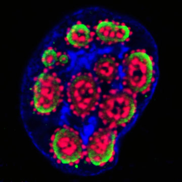 New Method Of Treating HIV By Protecting Human Cells From HIV Invasion