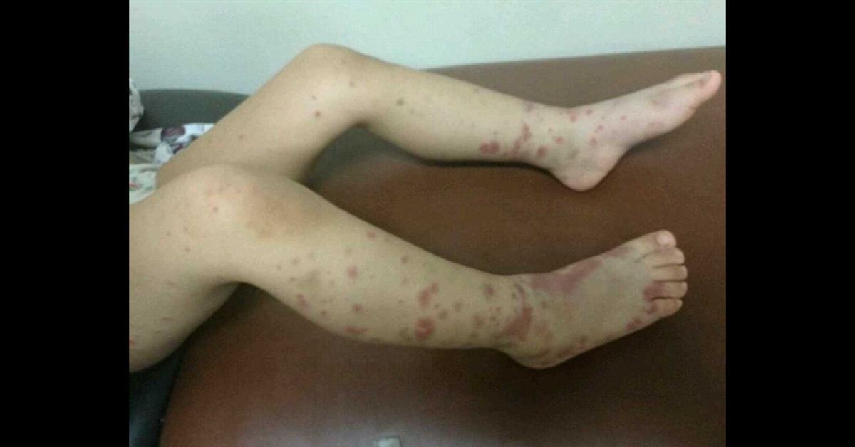 Diagnose The Underlying Condition