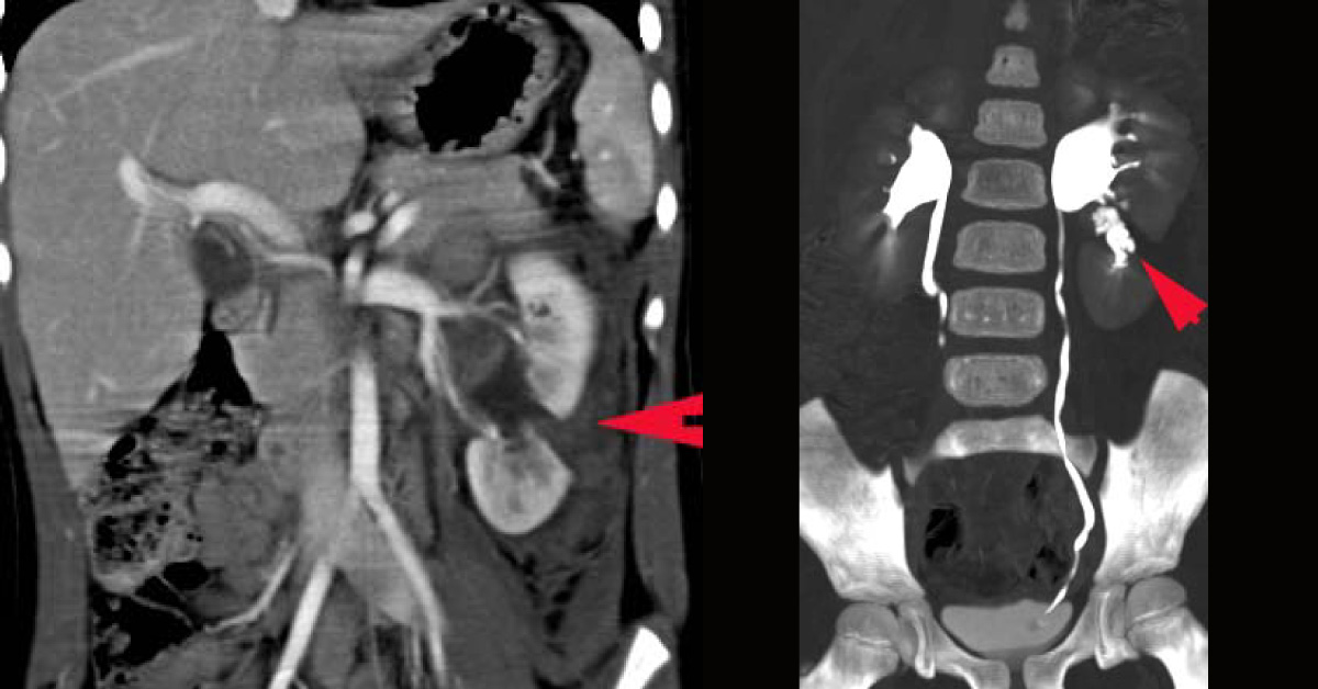 Interpret The Radiologic Findings