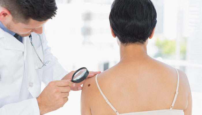 Artificial Intelligence Will Detect Melanoma, The Dreadly Skin Cancer