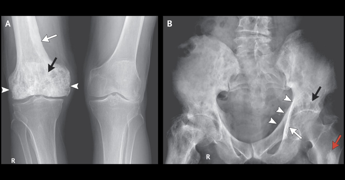 Spot The Condition From Attached Images