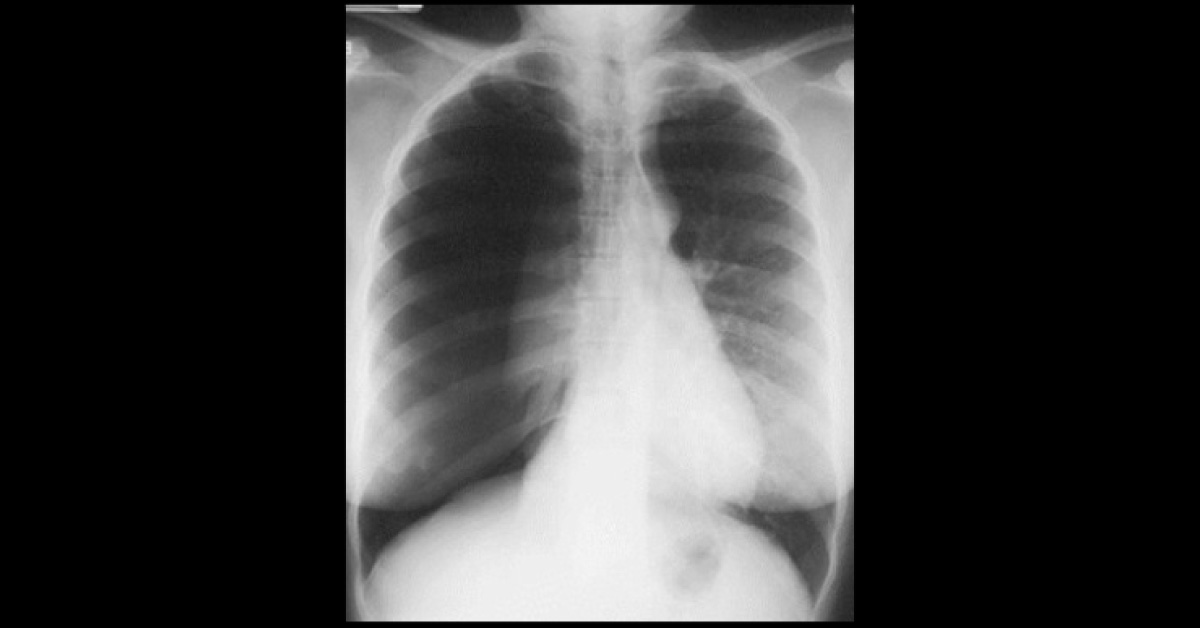 Interpret These Radiologic Findings