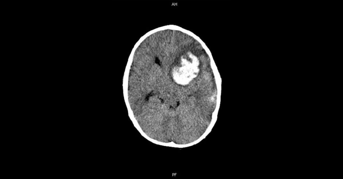 Solve This Critical Pediatric Case