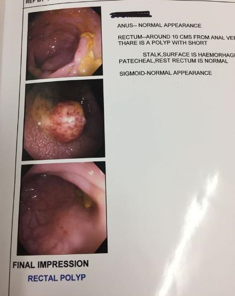 Bleeding Per Rectum In Teenager