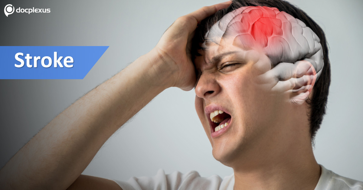 S2TOP-BLEED: A New Scoring Method To Predict Bleeding In Stroke Patients