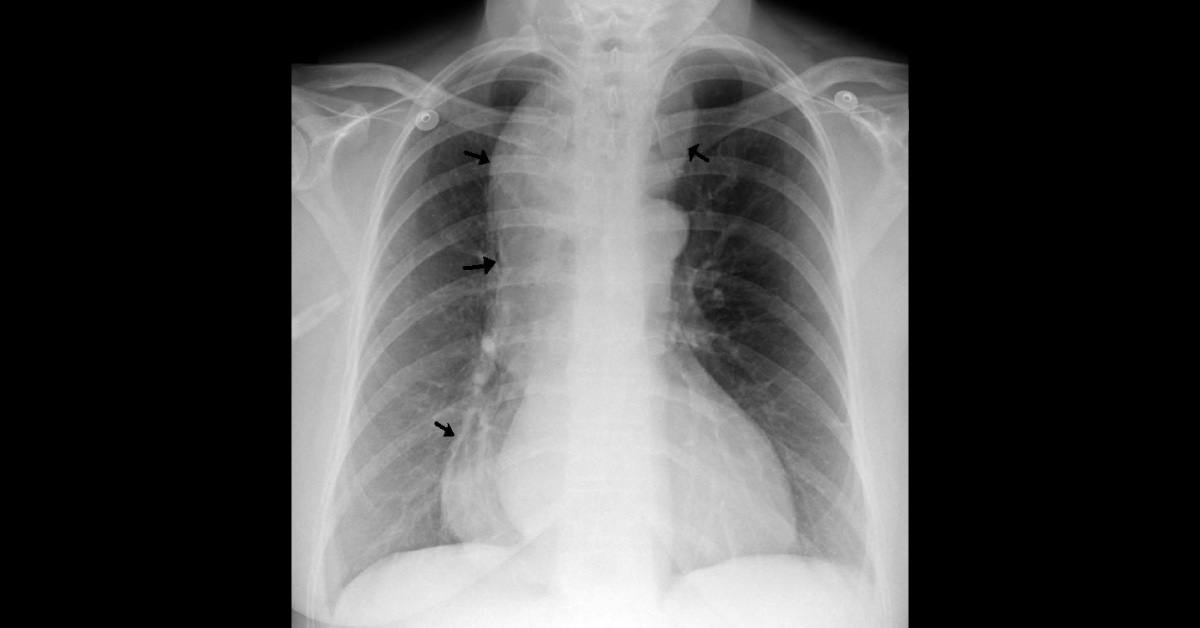 Identify The Abnormal Condition