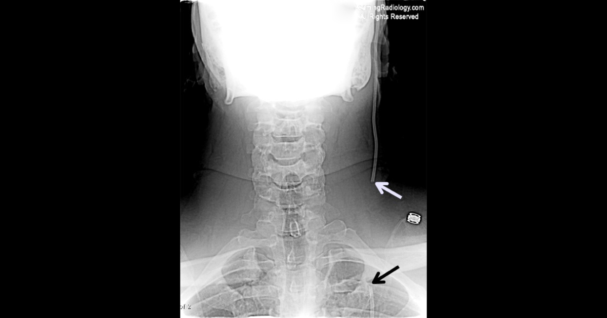 Radiology, Spot The Condition
