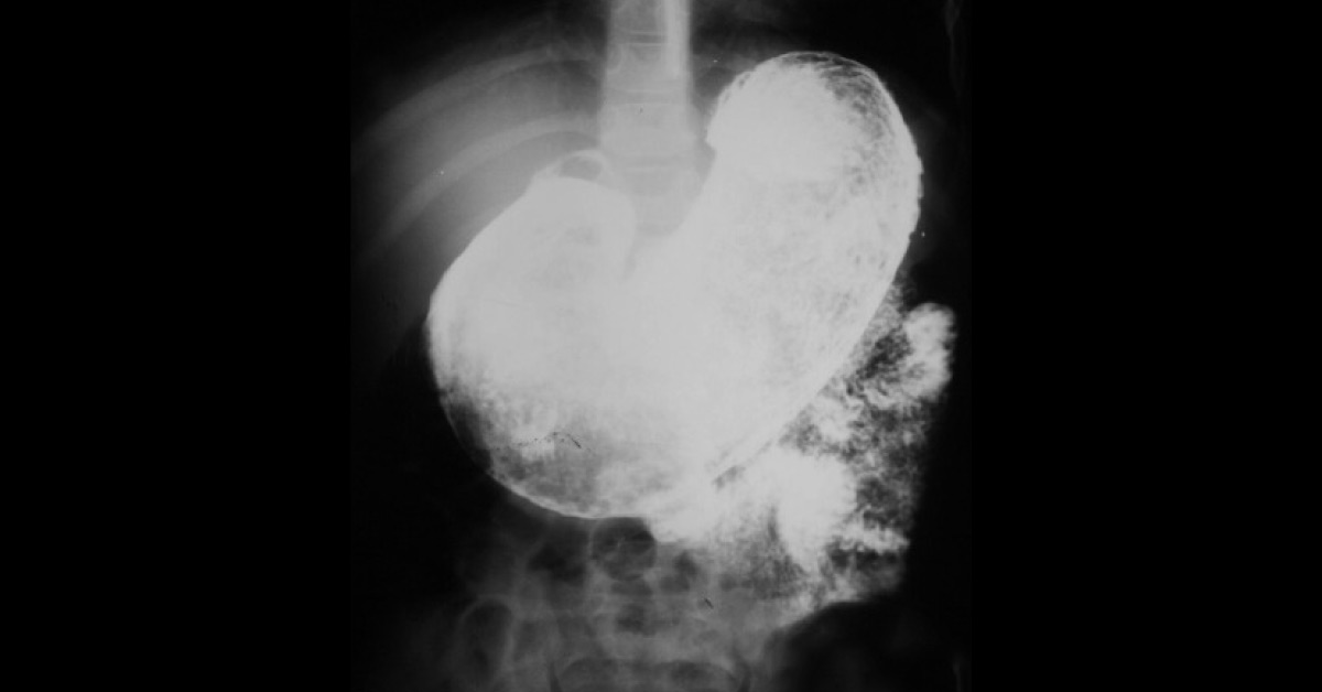 Identify The Radiograph