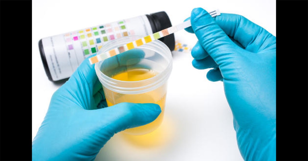 Therapeutic Approaches In Managing Proteinuria