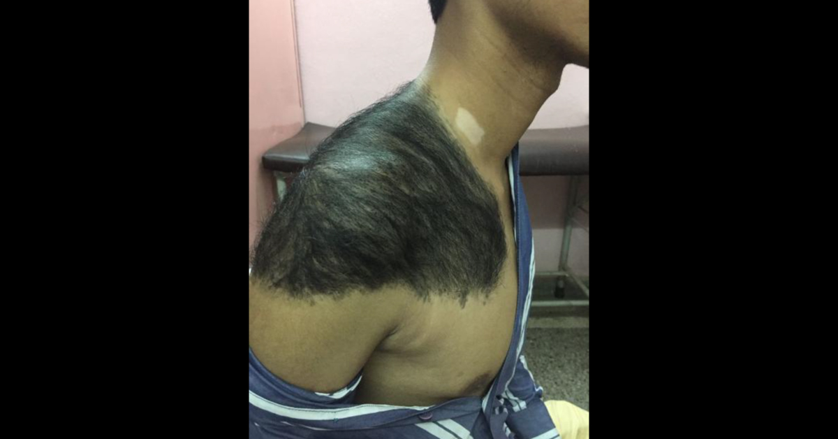 What Is This Skin Lesion Called? 