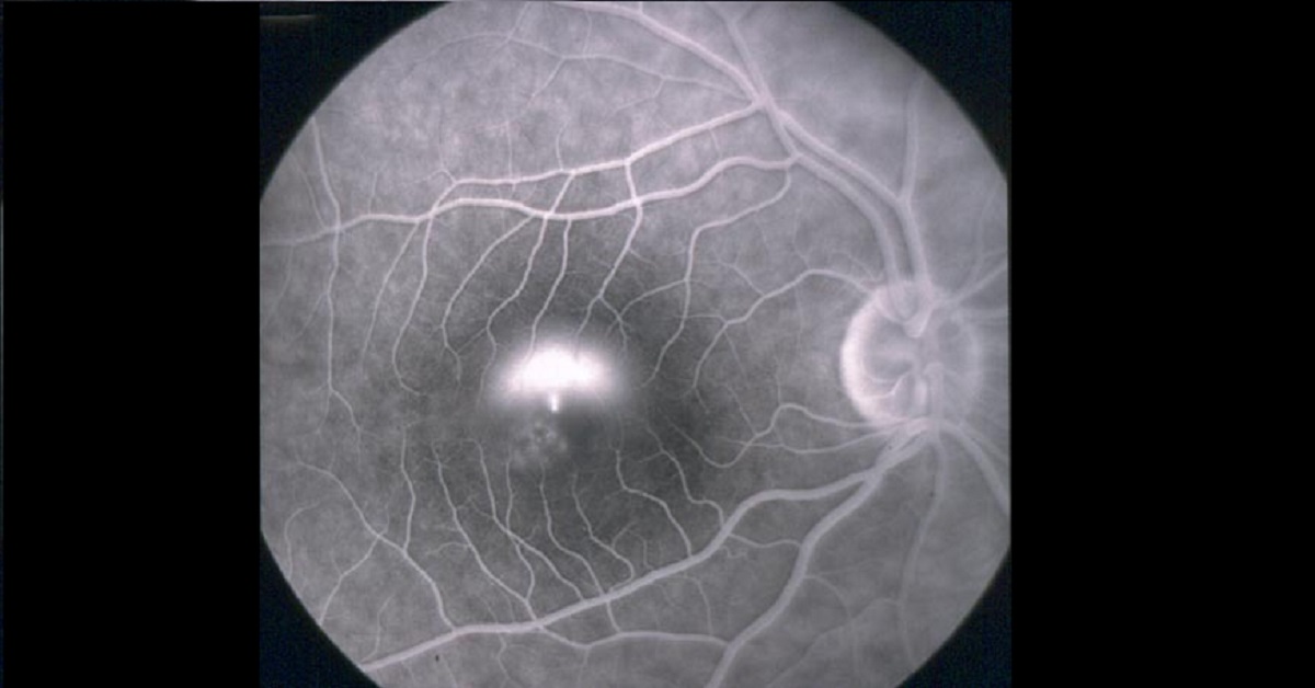 What Is The Likely Diagnosis?