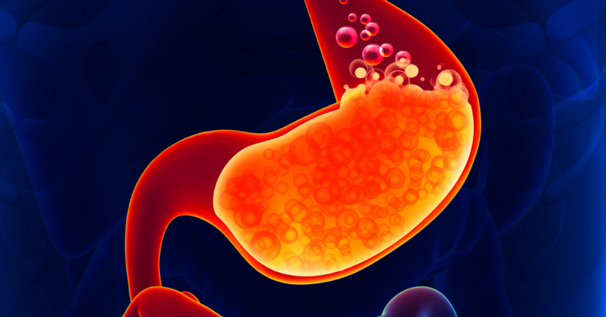 Acid Reflux, Prevalence and Treatment In India