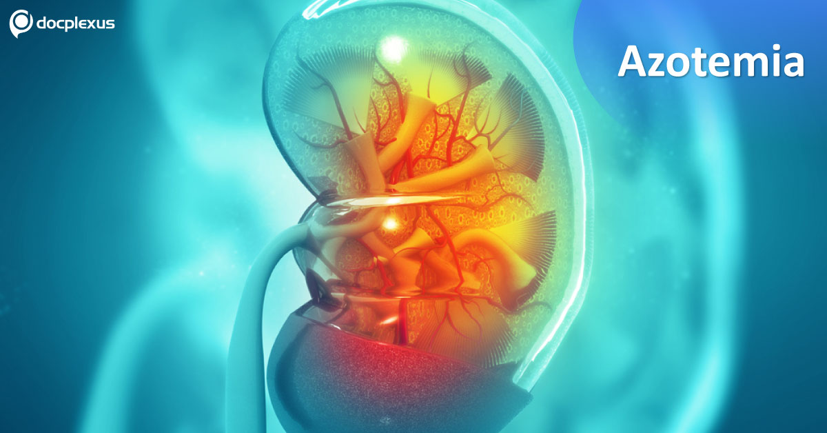 Azotemia, Types And Management