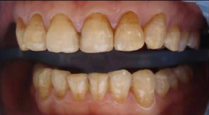 Oral And Dental Case Challenge