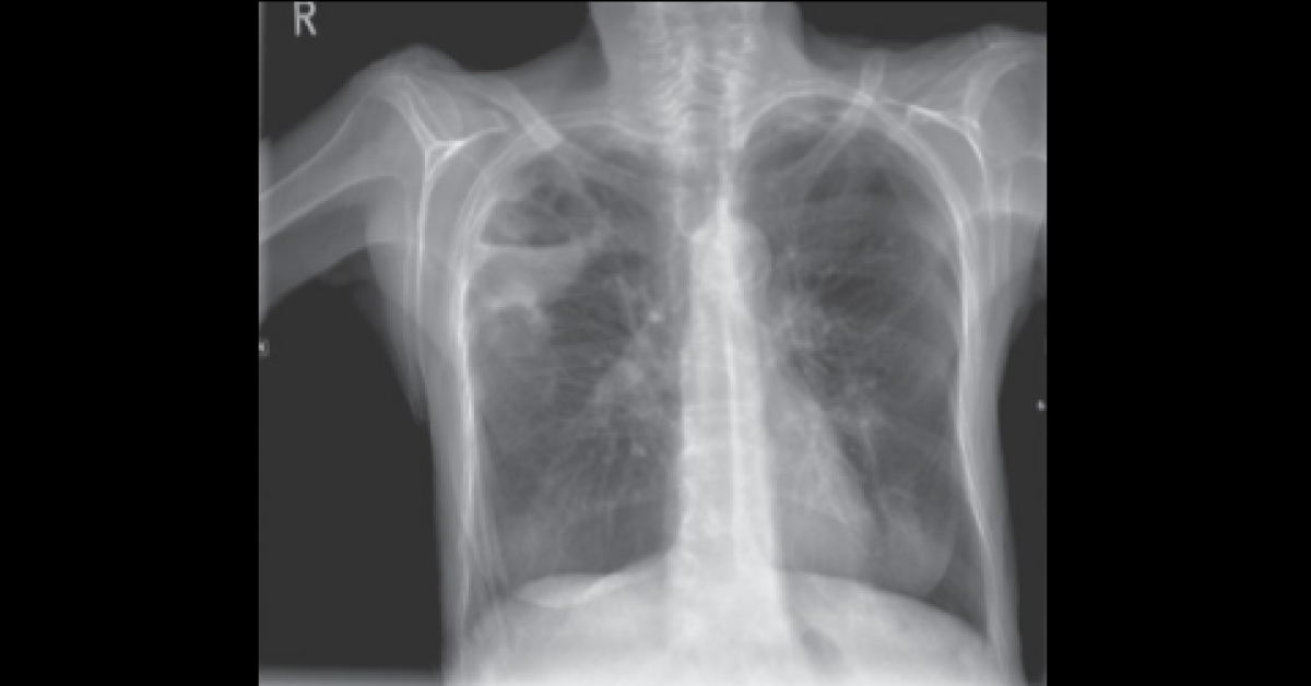 Identify This Abnormality?