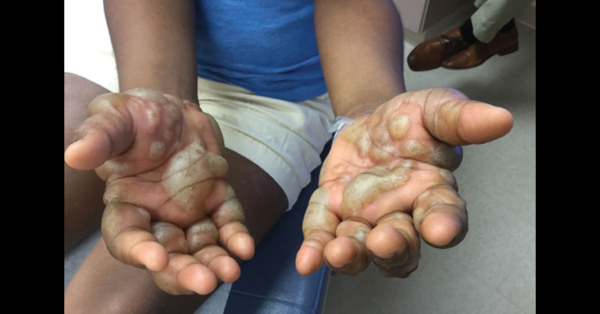 Solve This Pediatric Case