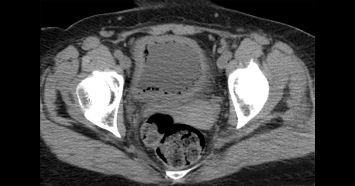 Identify This Condition