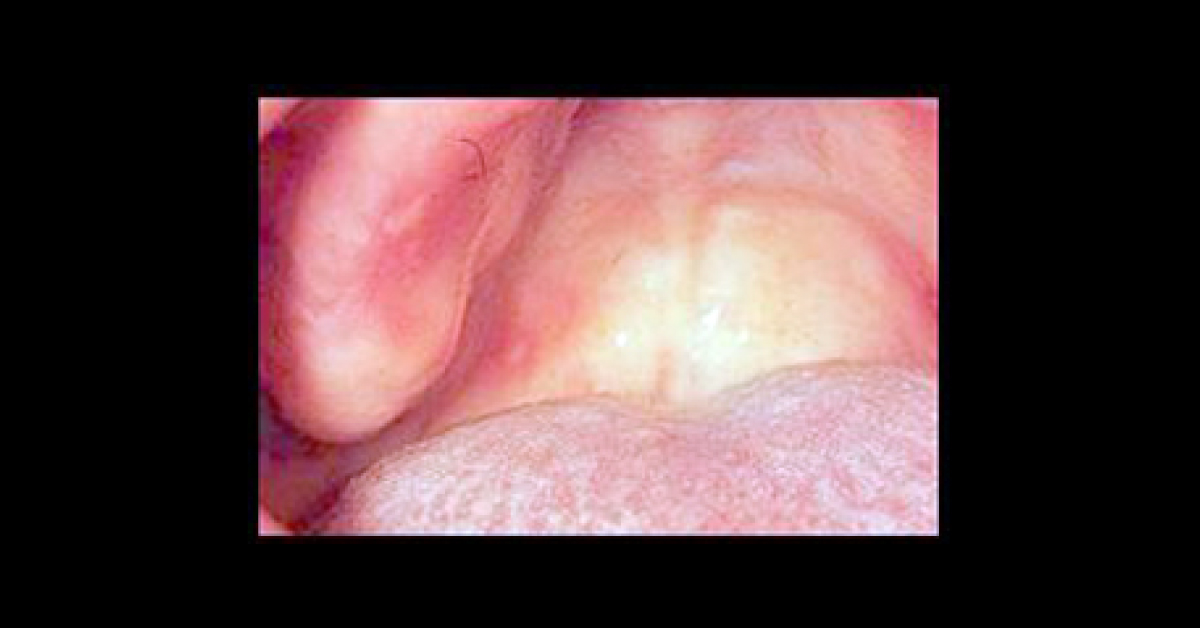 Identify This Condition?