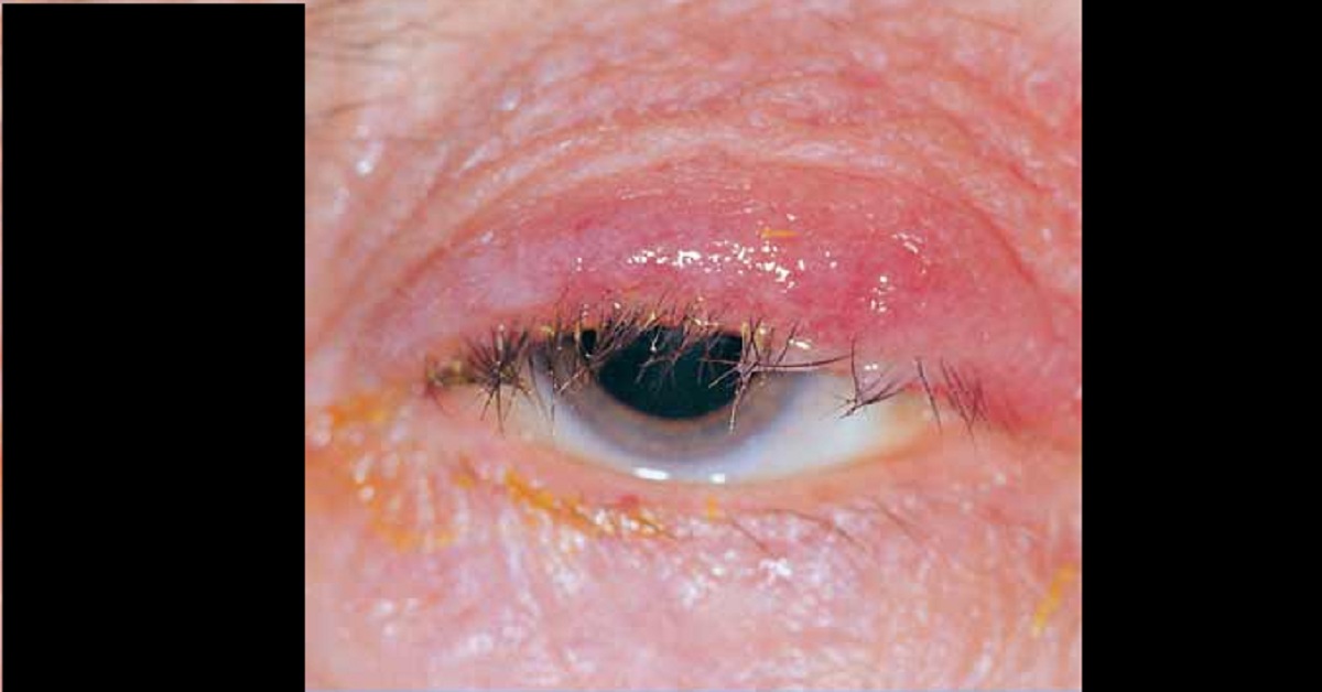 What Is Your Diagnosis?