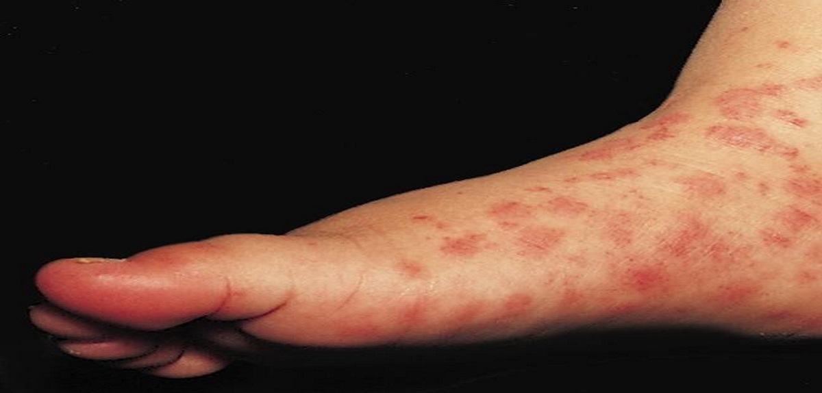 Spot The Dermatological Condition