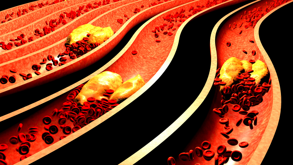 Good Cholesterol If Excessive May Be Bad For Our Body