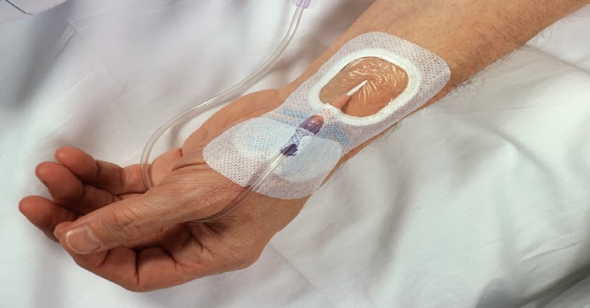 Catheter Related Bloodstream Infections And CDC Recommendations