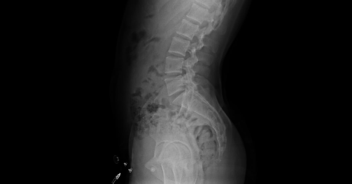 Solve This Neurology Case