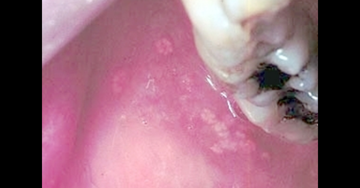Diagnose This Oral Condition