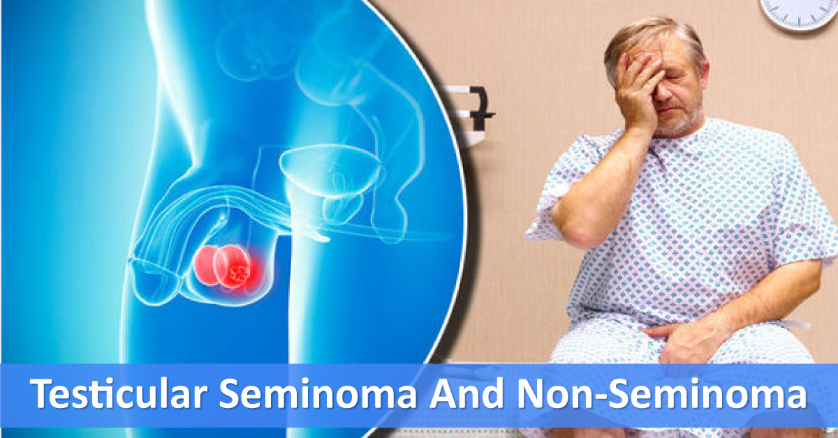 Testicular Seminoma And Non-seminoma