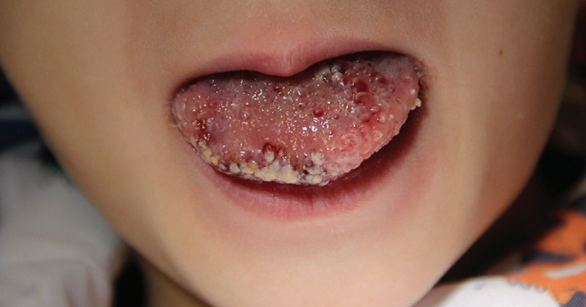 What Is This Condition?