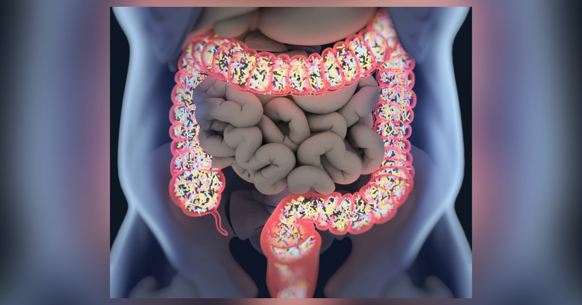 Probiotics May Help Treat Bowel Cancer - A New Study