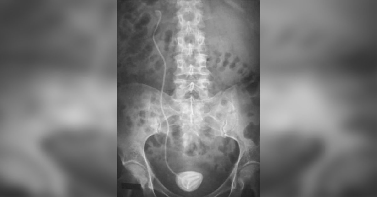 Urology Spot Diagnosis
