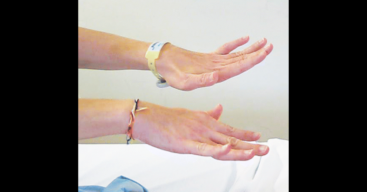 Identify This Neurological Condition