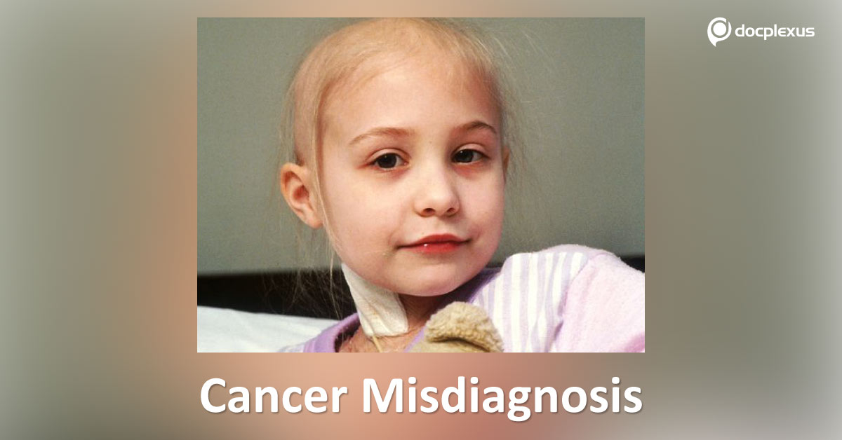Commonly Misdiagnosed Cancers