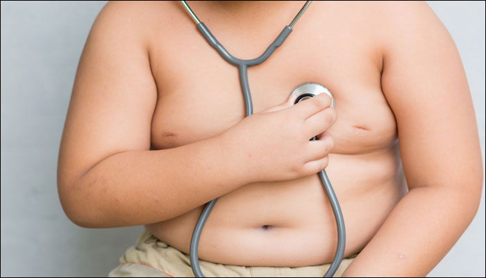 Bariatic Surgery In Obese Male May Cause Infertility