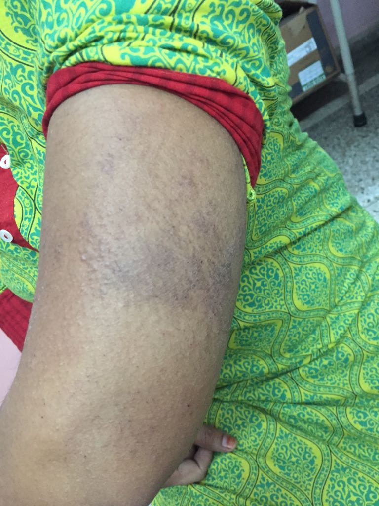What is this skin Problem?