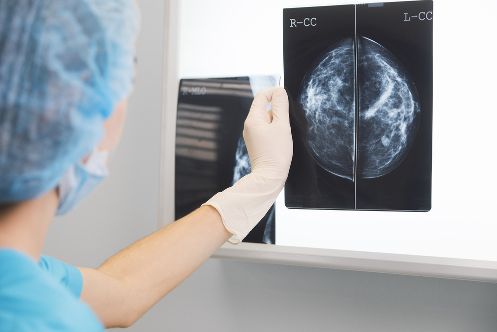 Lymphedema In Breast Cancer Patients, Diagnosis And Treatment
