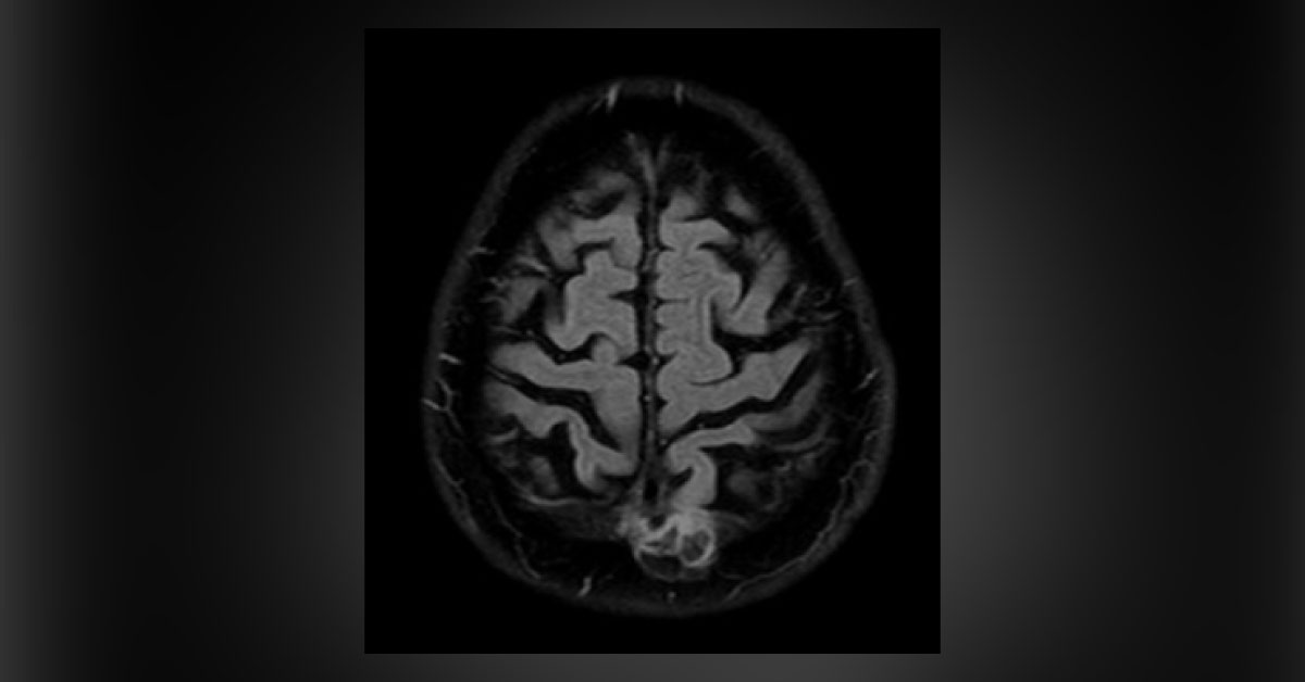 Solve This Unusual Radiological Case