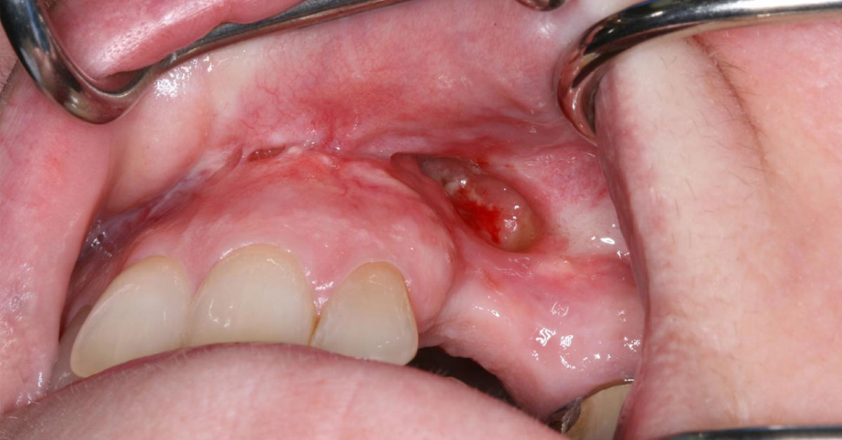 Detect The Oral Problem