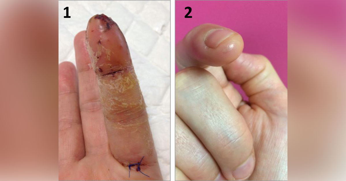 The Case Of Strange Injury To A Surgeon