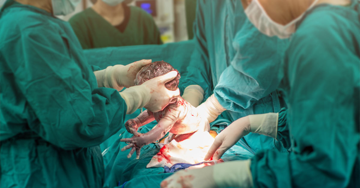 Tranexamic Acid And Post Partum Hemorrhage