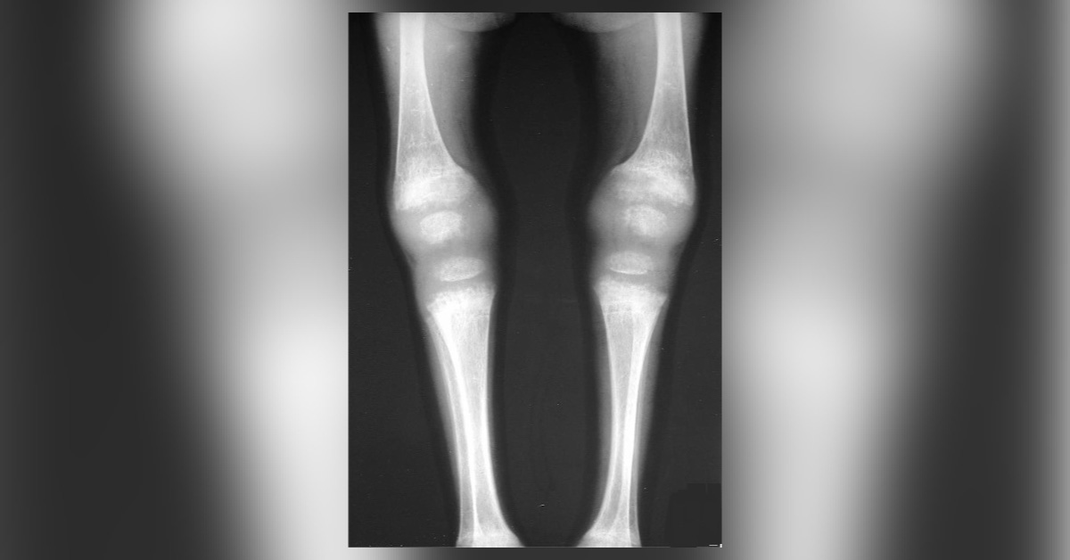 Interpret The Radiograph