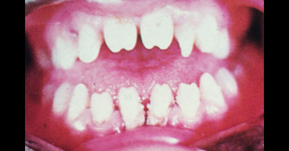 Spot The Congenital Condition
