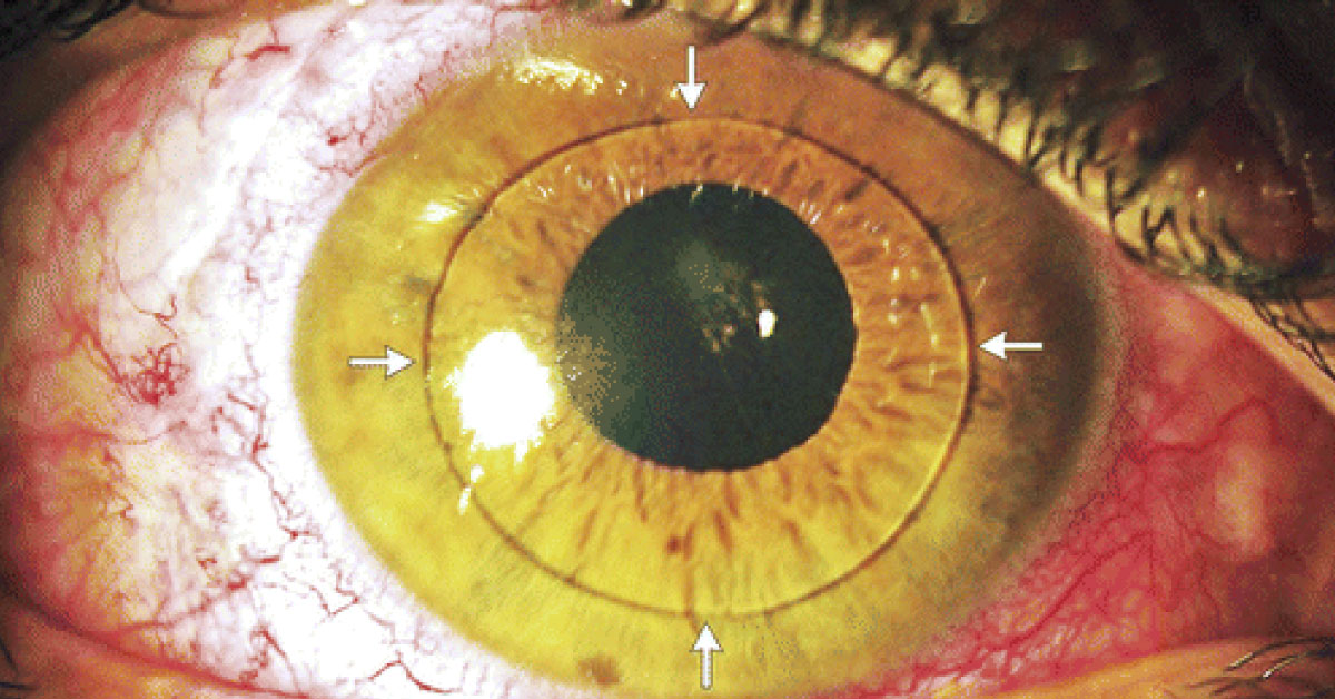 Spot This Complication